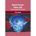 Human Prostate Cancer Cells: Detection, Growth and Treatment - Hardcover