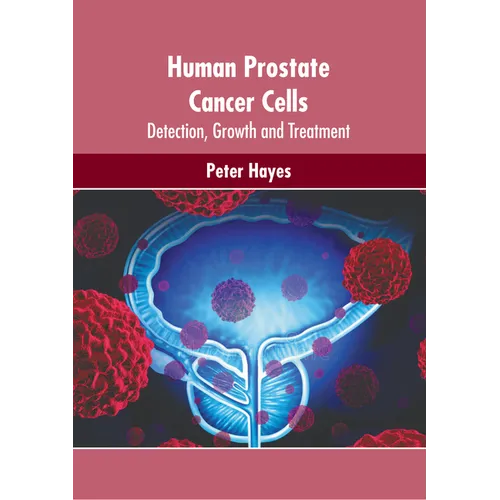 Human Prostate Cancer Cells: Detection, Growth and Treatment - Hardcover