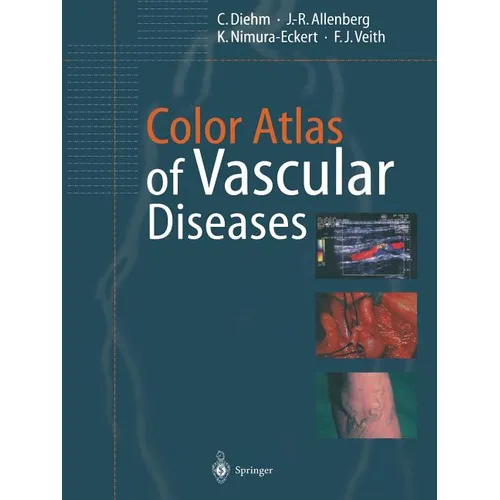 Color Atlas of Vascular Diseases - Paperback