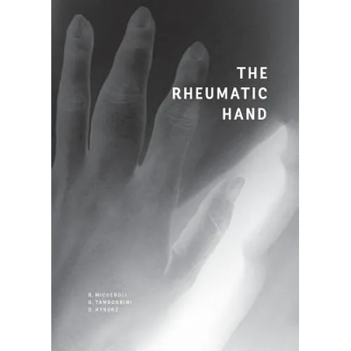 The Rheumatic Hand - Paperback