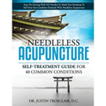 Needleless Acupuncture: Self-treatment guide for 40 common conditions - Paperback