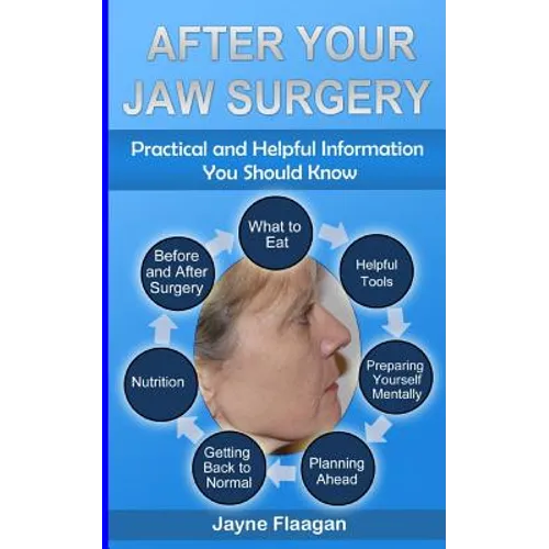 After Your Jaw Surgery: Practical and Helpful Information You Should Know - Paperback