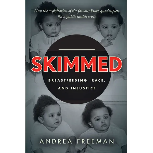 Skimmed: Breastfeeding, Race, and Injustice - Paperback