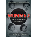 Skimmed: Breastfeeding, Race, and Injustice - Paperback