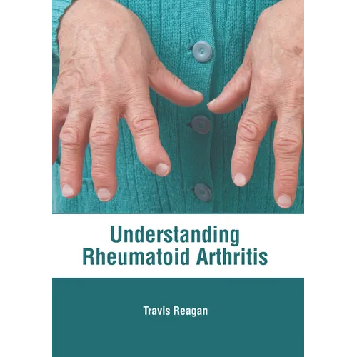Understanding Rheumatoid Arthritis - Hardcover
