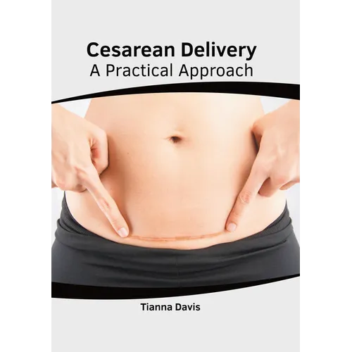 Cesarean Delivery: A Practical Approach - Hardcover