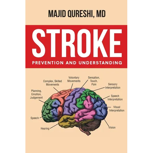 Stroke: Prevention and Understanding - Paperback