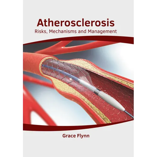 Atherosclerosis: Risks, Mechanisms and Management - Hardcover