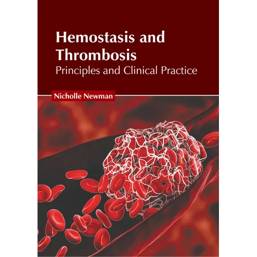 Hemostasis and Thrombosis: Principles and Clinical Practice - Hardcover