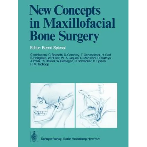 New Concepts in Maxillofacial Bone Surgery - Paperback
