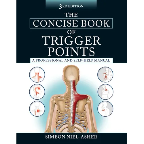The Concise Book of Trigger Points, Third Edition: A Professional and Self-Help Manual - Paperback