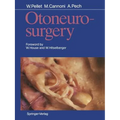 Otoneurosurgery - Paperback