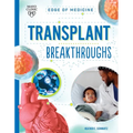 Transplant Breakthroughs - Paperback