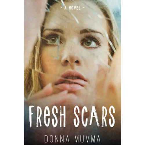 Fresh Scars - Paperback