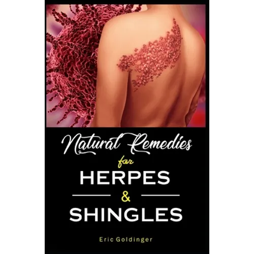 Natural Remedies For HERPES & SHINGLES: The Complete Guide - Paperback