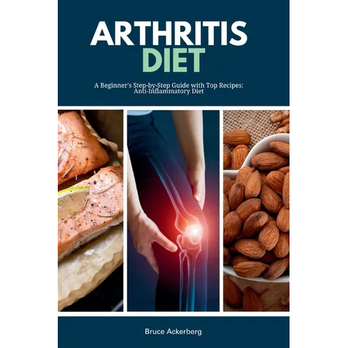 Arthritis Diet: A Beginner's Step-by-Step Guide with Top Recipes: Anti-Inflammatory Diet - Paperback
