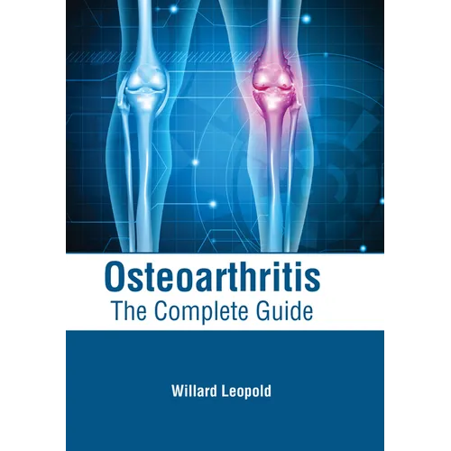 Osteoarthritis: The Complete Guide - Hardcover