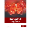 Non-Small Cell Lung Cancer - Hardcover