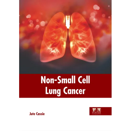 Non-Small Cell Lung Cancer - Hardcover
