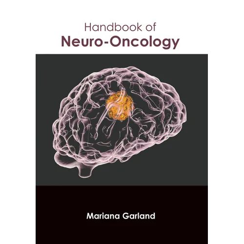Handbook of Neuro-Oncology - Hardcover