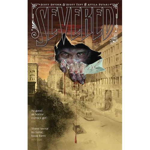 Severed - Paperback