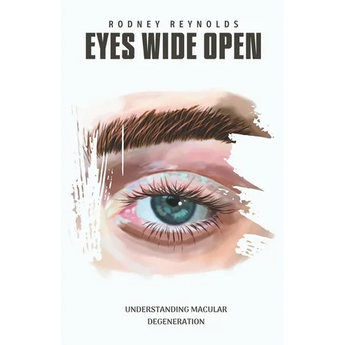 Eyes Wide Open: Understanding Macular Degeneration - Paperback