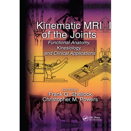Kinematic MRI of the Joints - Paperback