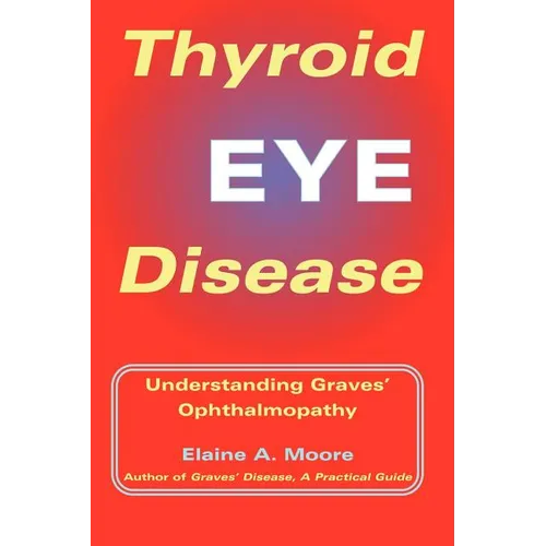 Thyroid Eye Disease: Understanding Graves' Ophthalmopathy - Paperback