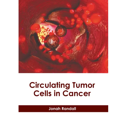 Circulating Tumor Cells in Cancer - Hardcover