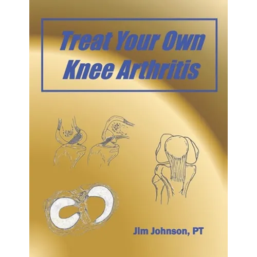 Treat Your Own Knee Arthritis - Paperback