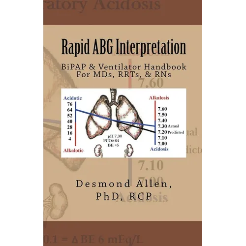 Rapid ABG Interpretation - BiPAP & Ventilator Handbook For MDs, RRTs, & RNs - Paperback