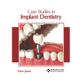 Case Studies in Implant Dentistry - Hardcover