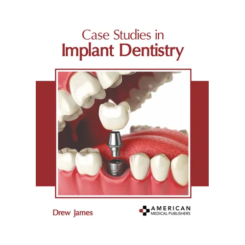 Case Studies in Implant Dentistry - Hardcover