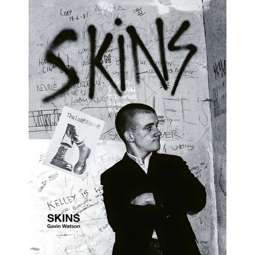 Skins: Gavin Watson - Hardcover