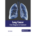 Lung Cancer: From Diagnosis to Treatment - Hardcover