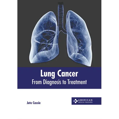 Lung Cancer: From Diagnosis to Treatment - Hardcover