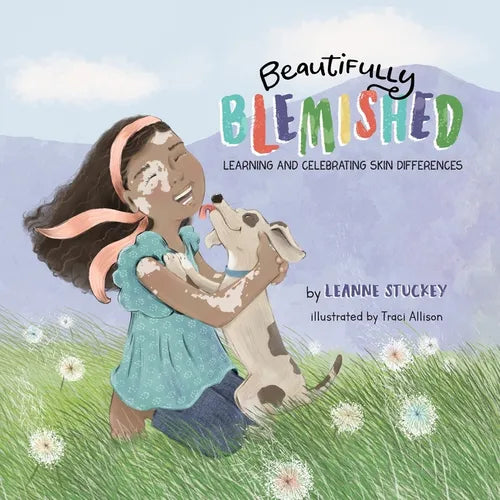 Beautifully Blemished: Learning and Celebrating Skin Differences - Paperback