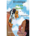 El vitiligo no me asusta - Hardcover