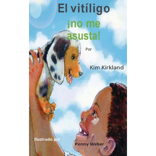 El vitiligo no me asusta - Hardcover