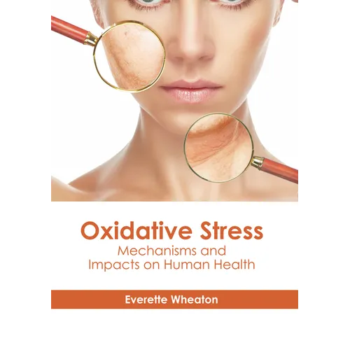Oxidative Stress: Mechanisms and Impacts on Human Health - Hardcover