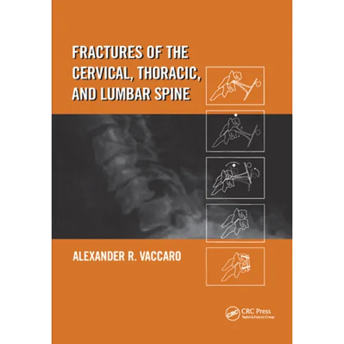 Fractures of the Cervical, Thoracic, and Lumbar Spine - Paperback