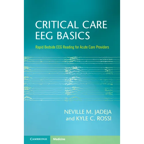 Critical Care EEG Basics - Paperback