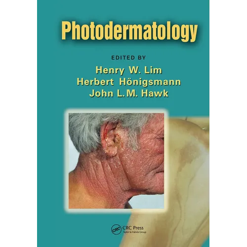 Photodermatology - Paperback
