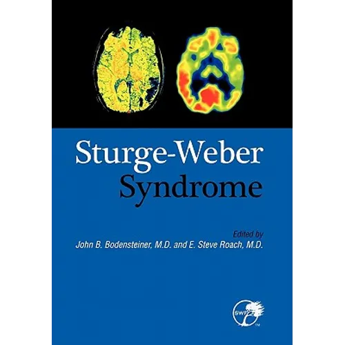 Sturge-Weber Syndrome - Hardcover