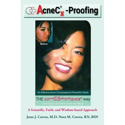 AcneC(R)X-Proofing: An Effective Acne Complications Prevention Book - Paperback