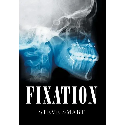 Fixation