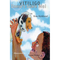 Vitiligo Doesn't Scare Me - Paperback