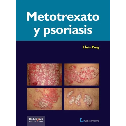 Metotrexato y psoriaris - Paperback
