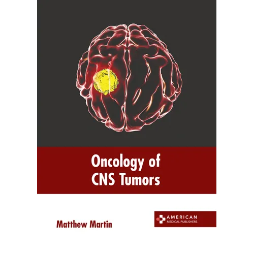 Oncology of CNS Tumors - Hardcover