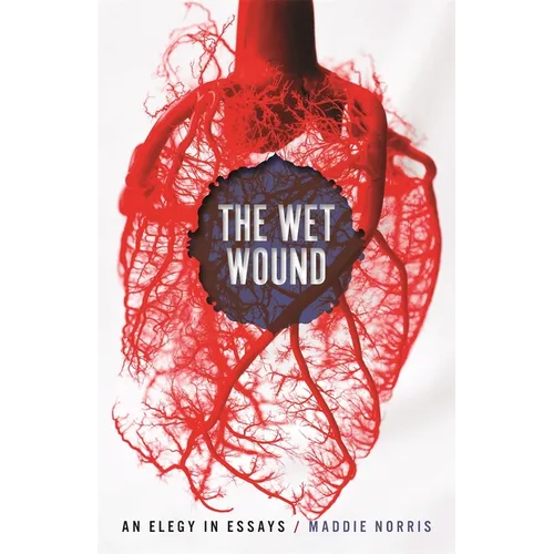 Wet Wound: An Elegy in Essays - Paperback